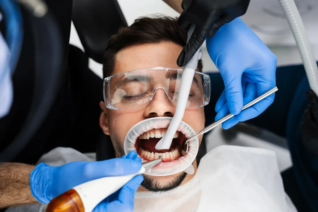 Cos’è la Guided Biofilm Therapy e come funziona? 1 Guided Biofilm Therapy
