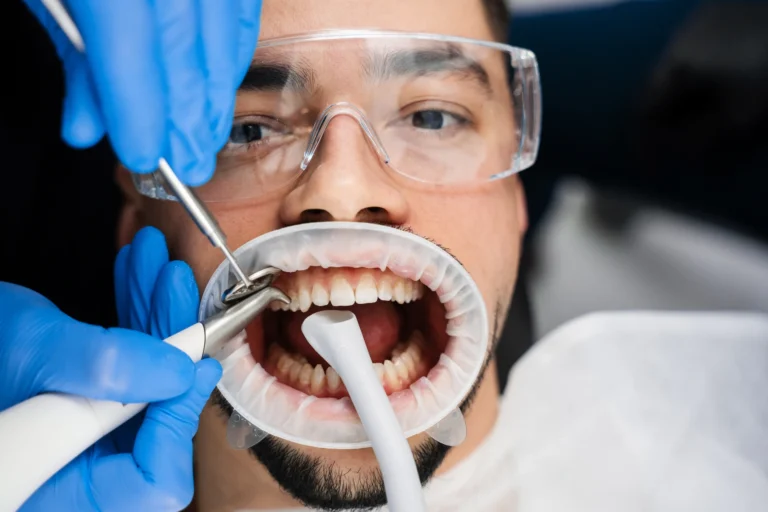 Guided Biofilm Therapy