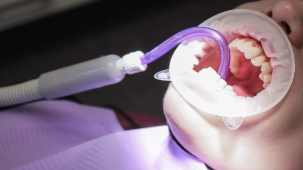 Pulizia dentale con Airflow: vantaggi rispetto agli ultrasuoni 1 pulizia dentale con Airflow