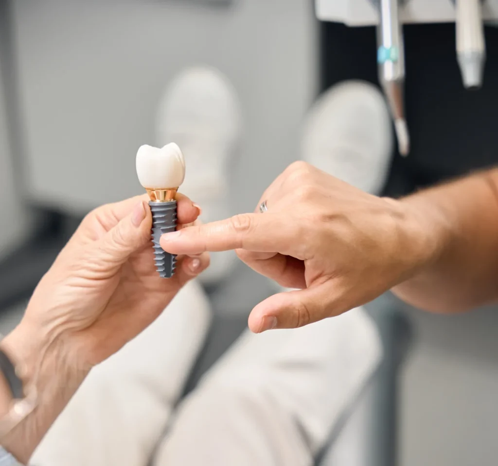 Differenza estetica tra impianto dentale e dente naturale 1 impianto dentale e dente naturale
